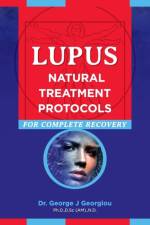 Lupus af George John Georgiou