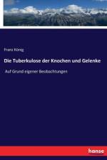 Tuberkulose der Knochen und Gelenke af Franz Koenig