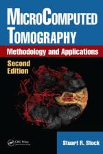 MicroComputed Tomography af Stuart R. Stock