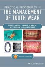 Practical Procedures in the Management of Tooth Wear af Subir (King's College London Dental Institute Banerji