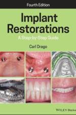 Implant Restorations af Carl Drago