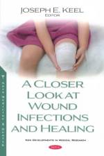 A Closer Look at Wound Infections and Healing