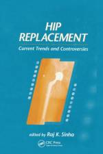 Hip Replacement af Raj K. Sinha