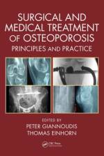 Surgical and Medical Treatment of Osteoporosis
