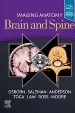 Imaging Anatomy Brain and Spine af Anne G. Osborn