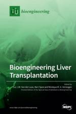 Bioengineering Liver Transplantation