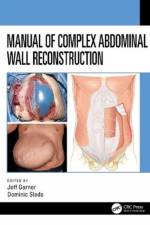 Manual of Complex Abdominal Wall Reconstruction