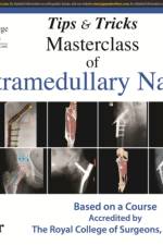 Tips and Tricks: Masterclass of Intramedullary Nailing af C S Halder