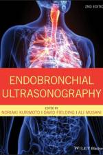 Endobronchial Ultrasonography af Noriaki (St Marianna University Kurimoto