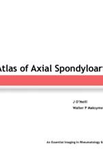 Imaging Atlas of Axial Spondyloarthritis af Walter Maksymowych