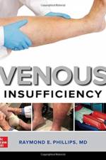 Venous Insufficiency af Raymond E. Phillips