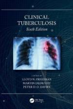 Clinical Tuberculosis