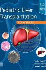 Pediatric Liver Transplantation af Nedim Hadzic