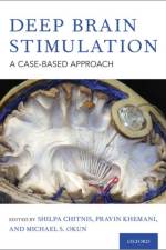 Deep Brain Stimulation af Shilpa Chitnis