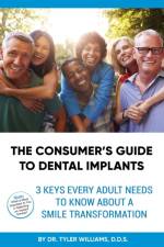 Consumer's Guide to Dental Implants af Dr Tyler