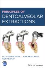 Principles of Dentoalveolar Extractions af Seth (University of Melbourne Delpachitra