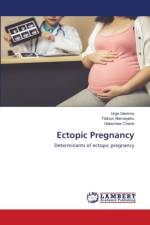 Ectopic Pregnancy af Urge Gerema
