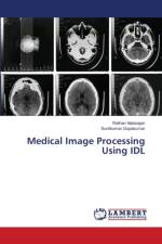 Medical Image Processing Using IDL af Rathan Natarajan