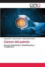 Cancer del pulmon af Hugo Esteva