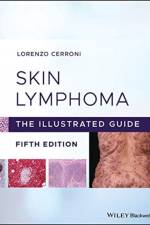 Skin Lymphoma af Lorenzo (Medical University of Graz Cerroni