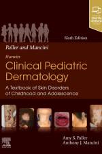 Paller and Mancini - Hurwitz Clinical Pediatric Dermatology af Amy S Paller
