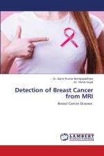Detection of Breast Cancer from MRI af Dr Samir Kumar Bandyopadhyay