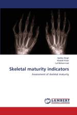 Skeletal maturity indicators af Aartika Singh