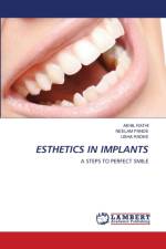 Esthetics in Implants af Akhil Rathi