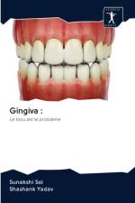 Gingiva af Shashank Yadav