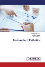 Peri-implant Esthetics af Pratibha Sharma