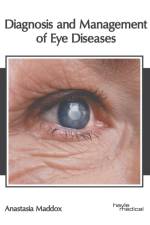 Diagnosis and Management of Eye Diseases