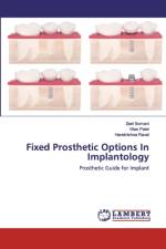 Fixed Prosthetic Options In Implantology af Vilas Patel