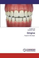 Gingiva af Shashank Yadav