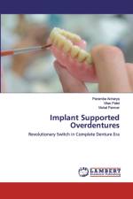 Implant Supported Overdentures af Vilas Patel