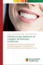 Influencia dos adesivos na colagem de Brackets Ceramicos af Leandro Lorenzi Rasia Dal Polo