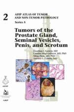 Tumors of the Prostate Gland, Seminal Vesicles, Penis, and Scrotum af Jonathan I. Epstein