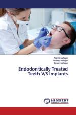 Endodontically Treated Teeth V/S Implants af Pardeep Mahajan