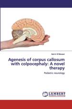 Agenesis of corpus callosum with colpocephaly af Aamir Al Mosawi