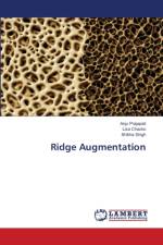 Ridge Augmentation af Anju Prajapati
