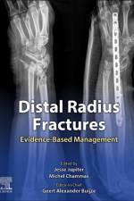 Distal Radius Fractures af Jupiter
