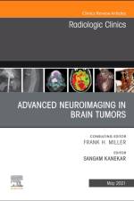 Advanced Neuroimaging in Brain Tumors, An Issue of Radiologic Clinics of North America af Sangam Kanekar