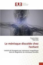 menisque discoide chez l'enfant af Khaoula Sibbou