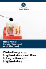 Einheilung von Implantaten und Bio- Integration von Implantaten af Munjal Neha Munjal