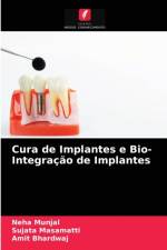 Cura de Implantes e Bio- Integracao de Implantes af Munjal Neha Munjal