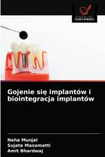 Gojenie sie implantow i biointegracja implantow af Munjal Neha Munjal