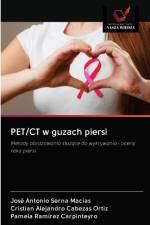 PET/CT w guzach piersi af Serna Macias Jose Antonio Serna Macias