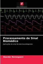 Processamento de Sinal Biomedico af Bensegueni Skander Bensegueni