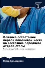 Влияние остеотомии первой плюсневой кост af а