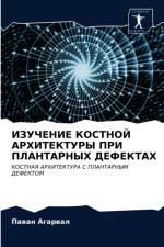 ИЗУЧЕНИЕ КОСТНОЙ АРХИТЕКТУРЫ ПРИ ПЛАНТАР af г