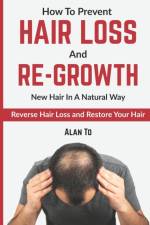 How To Prevent Hair Loss And Re-Growth New Hair In A Natural Way af Alan To